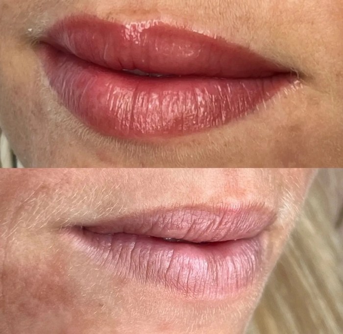 Before and after lip blush tattoo by Emmanita Cosmetic Tattoo